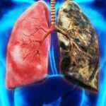 Pentingnya Peran Paru-paru dalam Kesehatan Tubuh